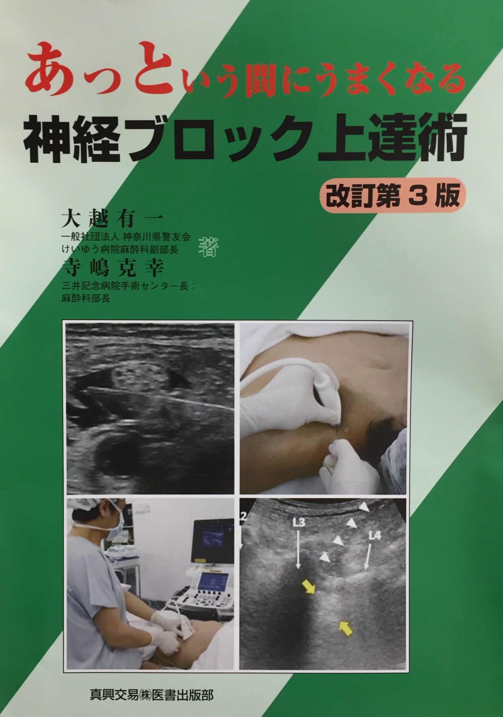 �����_�o�u���b�N,�_�o�u���b�N,�G�R�[�K�C�h,����,�摜,Bezold,Jarisch