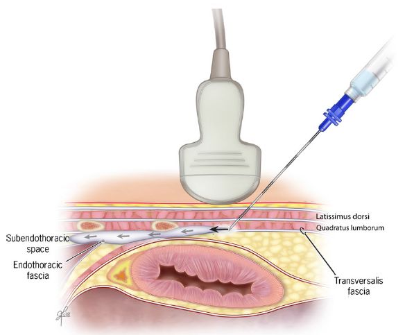 �����_�o�u���b�N,�_�o�u���b�N,�G�R�[�K�C�h,����,�摜