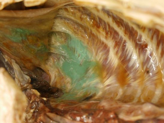 末梢神経ブロック,神経ブロック,エコーガイド,動画,画像