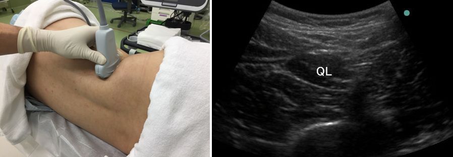 �����_�o�u���b�N,�_�o�u���b�N,�G�R�[�K�C�h,����,�摜