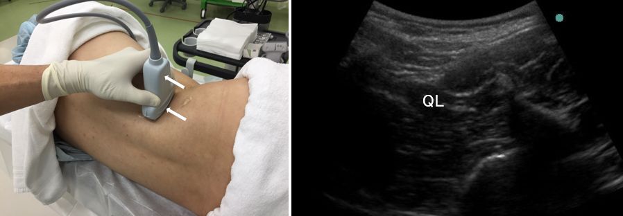 �����_�o�u���b�N,�_�o�u���b�N,�G�R�[�K�C�h,����,�摜