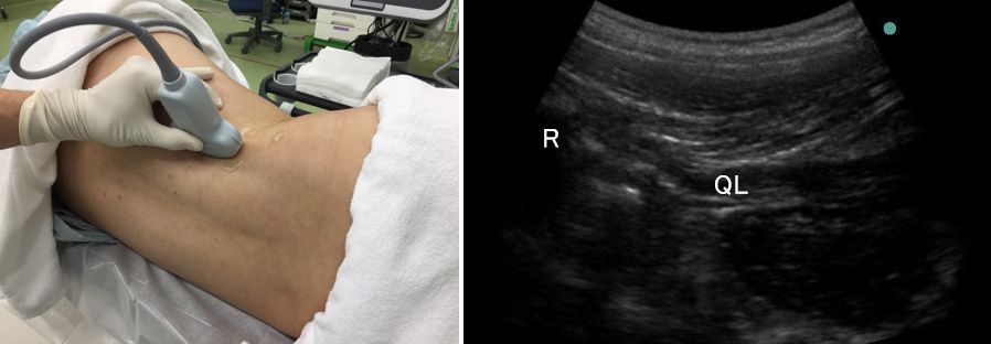 �����_�o�u���b�N,�_�o�u���b�N,�G�R�[�K�C�h,����,�摜