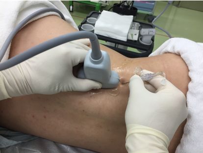 �����_�o�u���b�N,�_�o�u���b�N,�G�R�[�K�C�h,����,�摜