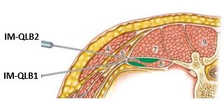 �����_�o�u���b�N,�_�o�u���b�N,�G�R�[�K�C�h,����,�摜