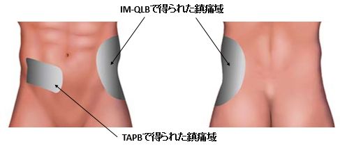 �����_�o�u���b�N,�_�o�u���b�N,�G�R�[�K�C�h,����,�摜