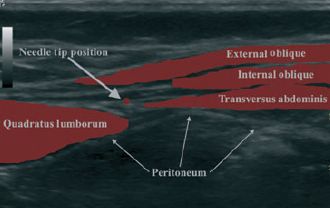 �����_�o�u���b�N,�_�o�u���b�N,�G�R�[�K�C�h,����,�摜