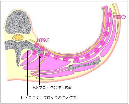�����_�o�u���b�N,�_�o�u���b�N,�G�R�[�K�C�h,����,�摜